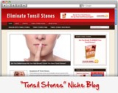 Product picture Tonsil Stones